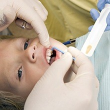 Child receiving fluoride treatment