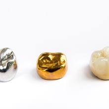Silver, gold, and white dental crown on white background