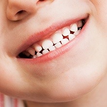 Closeup of child's smile