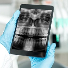 Digital dental x-rays on tablet computer