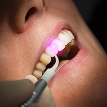 Closeup of patient receiving soft tissue laser treatment