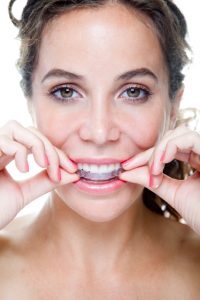 Learn about straightening your teeth as an adult with Invisalign in Virginia Beach.