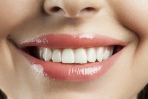 Benefit from your cosmetic dentist in Virginia Beach.