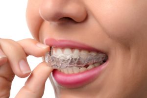 What makes me a good candidate for Invisalign in Virginia Beach, VA?