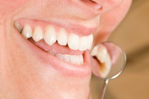 Dental implants in Virginia Beach are a comprehensive replacement option. 