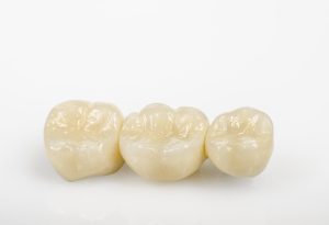 porcelain crowns