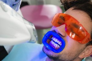 man with gums protected teeth whitening