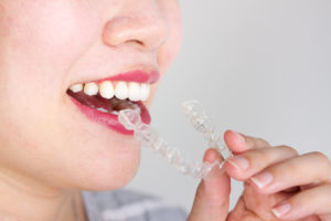 woman smiling happily Invisalign tray