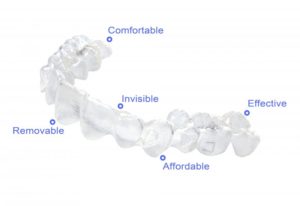 Invisalign aligners