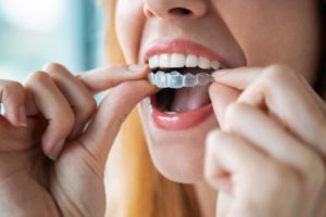 a woman putting her Invisalign aligners in her mouth