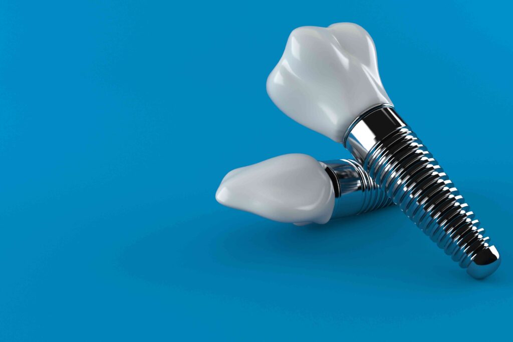Dental implants on a blue background
